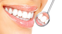 LASER TEETH WHITENING